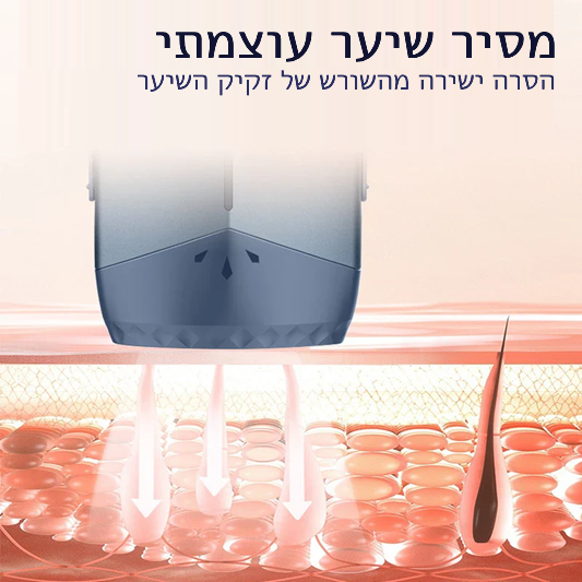 MLAY - מכשיר להסרת שיער בלייזר ביתי
